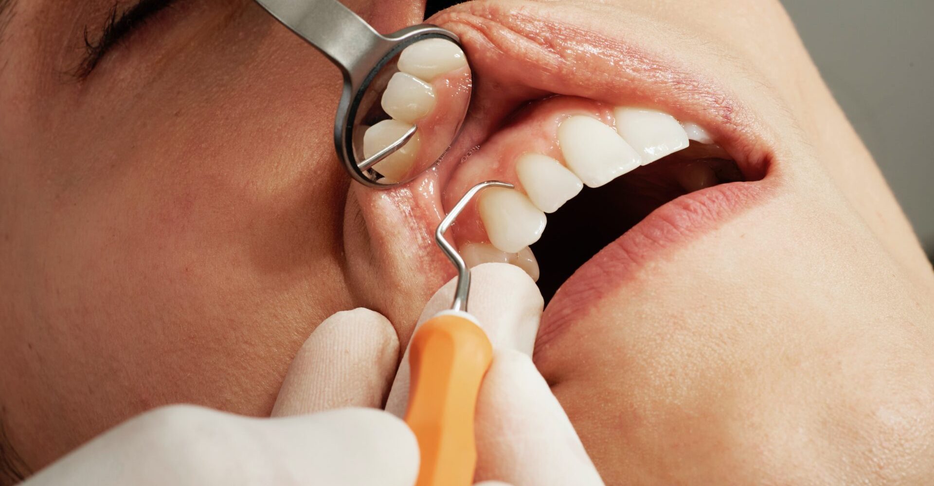 dentist teeth cleaning